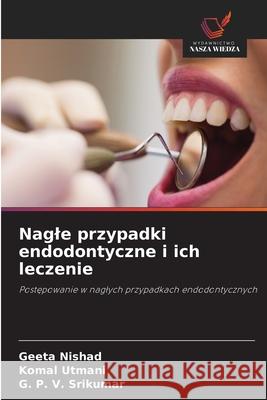 Nagle przypadki endodontyczne i ich leczenie Nishad, Geeta, Utmani, Komal, Srikumar, G. P. V. 9786209327131 Wydawnictwo Nasza Wiedza