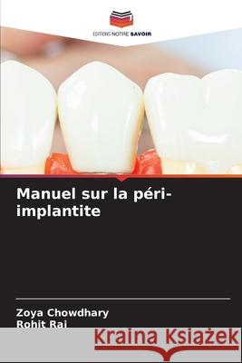 Manuel sur la péri-implantite Chowdhary, Zoya, Rai, Rohit 9786209330841