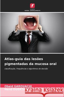 Atlas-guia das les?es pigmentadas da mucosa oral Obaid Garouachi Hend Ouertani 9786209332128