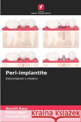 Peri-implantite Kaur, Navnit, Kaur, Harjit, Jain, Sanjeev 9786209338014