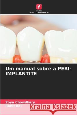 Um manual sobre a PERI-IMPLANTITE Chowdhary, Zoya, Rai, Rohit 9786209338526