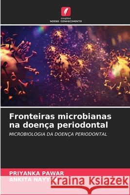 Fronteiras microbianas na doença periodontal Pawar, Priyanka, NAYYAR, ANKITA 9786209351273