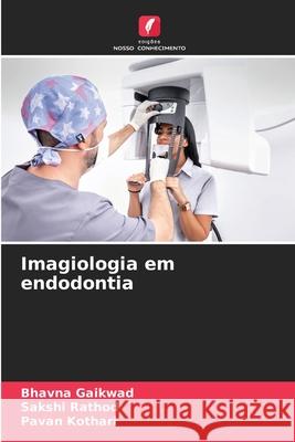 Imagiologia em endodontia Gaikwad, Bhavna, Rathod, Sakshi, Kothari, Pavan 9786209370335