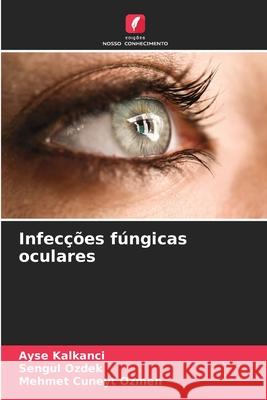Infecções fúngicas oculares Kalkanci, Ayse, Ozdek, Sengul, Ozmen, Mehmet Cuneyt 9786209383502