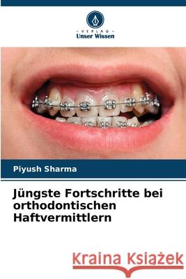 Jüngste Fortschritte bei orthodontischen Haftvermittlern Sharma, Piyush 9786209387173 Verlag Unser Wissen