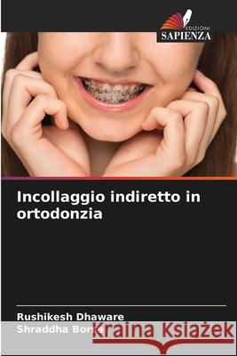 Incollaggio indiretto in ortodonzia Dhaware, Rushikesh, Borse, Shraddha 9786209390326