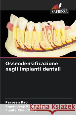 Osseodensificazione negli impianti dentali Rao, Parveen, Samra, Rupandeep Kaur, Chaudhary, Sunita 9786209392863