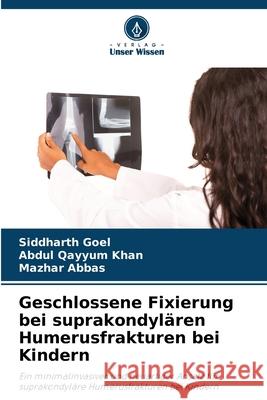Geschlossene Fixierung bei suprakondylären Humerusfrakturen bei Kindern Goel, Siddharth, Khan, Abdul Qayyum, Abbas, Mazhar 9786209395109