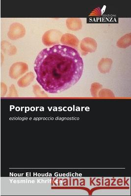 Porpora vascolare Guediche, Nour El Houda, Khrifech, Yesmine 9786209403774