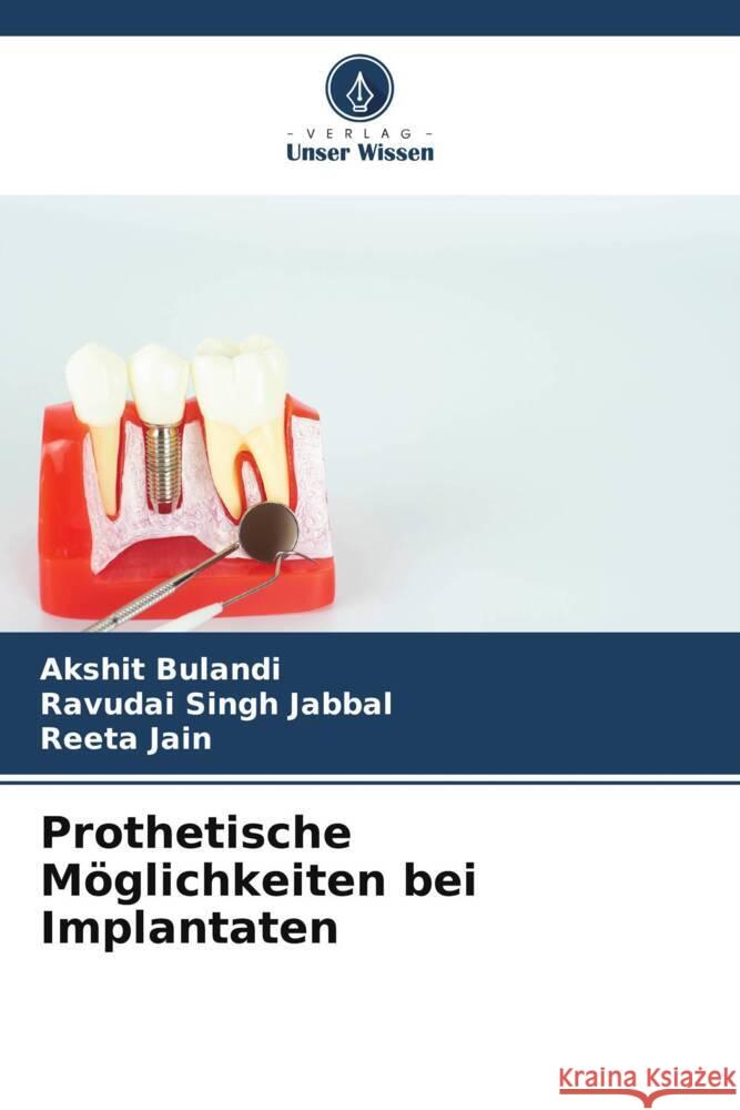 Prothetische Möglichkeiten bei Implantaten Bulandi, Akshit, Jabbal, Ravudai Singh, Jain, Reeta 9786209455896 Verlag Unser Wissen