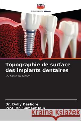 Topographie de surface des implants dentaires Dolly Dashore Prof Sumeet Jain 9786209459153