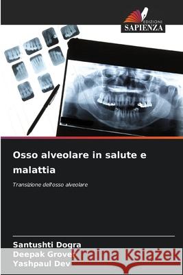 Osso alveolare in salute e malattia Dogra, Santushti, Grover, Deepak, Dev, Yashpaul 9786209465383