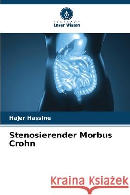 Stenosierender Morbus Crohn Hassine, Hajer 9786209468421 Verlag Unser Wissen