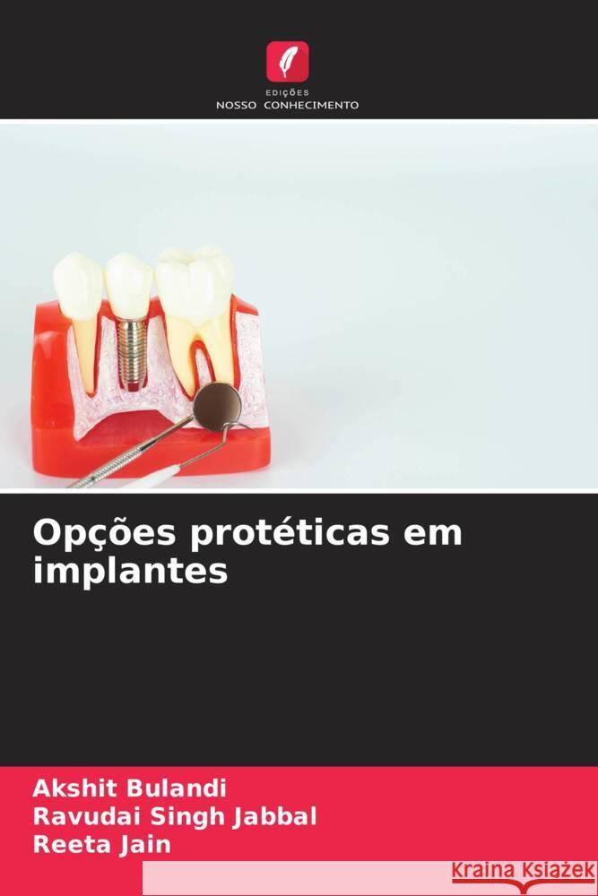Opções protéticas em implantes Bulandi, Akshit, Jabbal, Ravudai Singh, Jain, Reeta 9786209468698 Edições Nosso Conhecimento