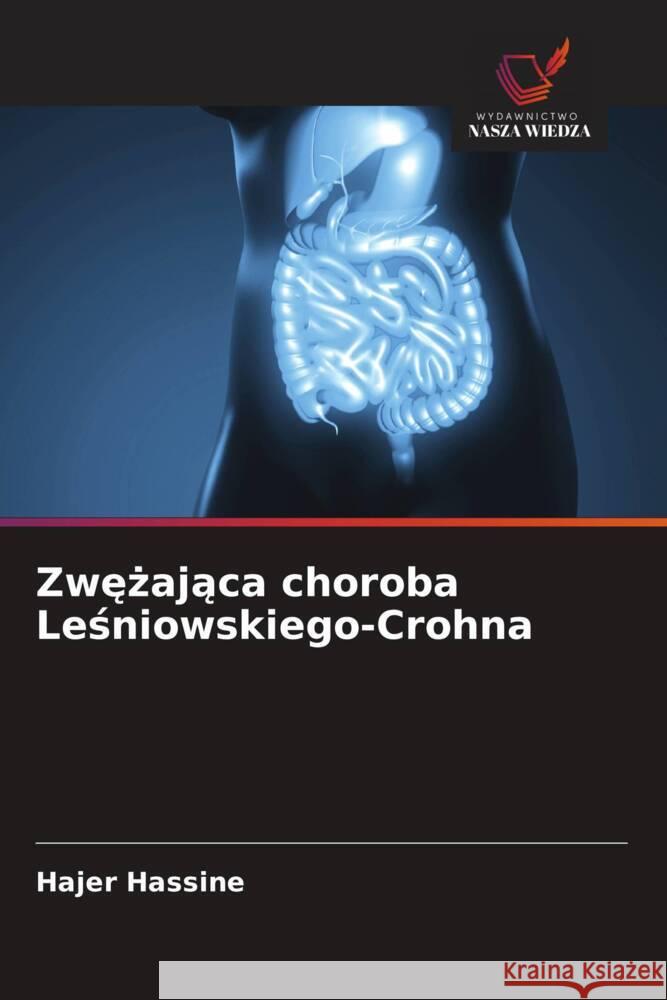 Zwezajaca choroba Lesniowskiego-Crohna Hassine, Hajer 9786209481222 Wydawnictwo Nasza Wiedza