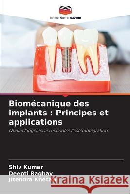Biom?canique des implants: Principes et applications Shiv Kumar Deepti Raghav Jitendra Khetan 9786209483493