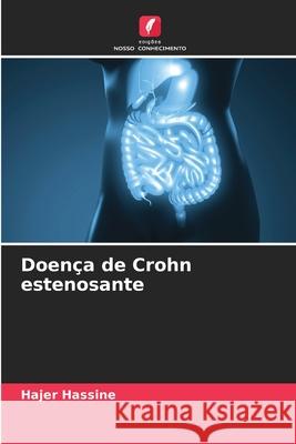 Doença de Crohn estenosante Hassine, Hajer 9786209483783 Edições Nosso Conhecimento