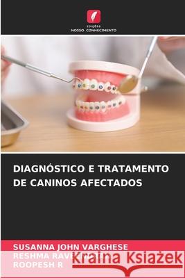 DIAGNÓSTICO E TRATAMENTO DE CANINOS AFECTADOS VARGHESE, SUSANNA JOHN, RAVEENDRAN, RESHMA, R, ROOPESH 9786209493157 Edições Nosso Conhecimento