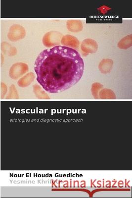 Vascular purpura Guediche, Nour El Houda, Khrifech, Yesmine 9786209495922