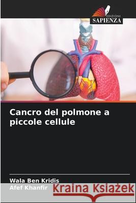 Cancro del polmone a piccole cellule BEN KRIDIS, Wala, Khanfir, Afef 9786209500411