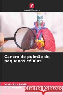 Cancro do pulmão de pequenas células BEN KRIDIS, Wala, Khanfir, Afef 9786209505539