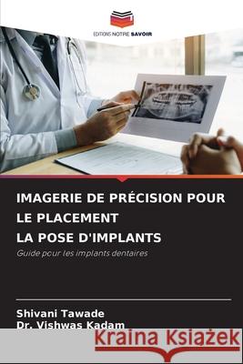 IMAGERIE DE PRÉCISION POUR LE PLACEMENT LA POSE D'IMPLANTS Tawade, Shivani, Kadam, Dr. Vishwas 9786209527746