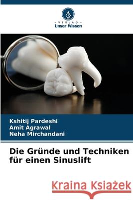 Die Gr?nde und Techniken f?r einen Sinuslift Kshitij Pardeshi Amit Agrawal Neha Mirchandani 9786209552373 Verlag Unser Wissen