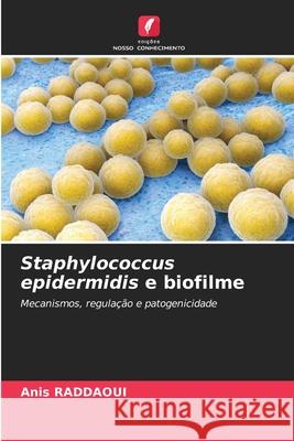 Staphylococcus epidermidis e biofilme RADDAOUI, Anis 9786209570766 Edições Nosso Conhecimento