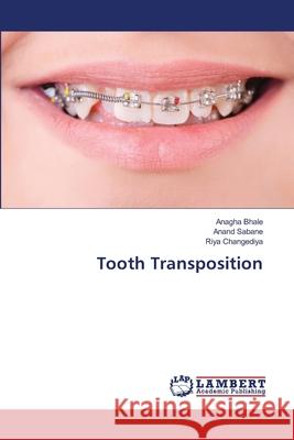 Tooth Transposition Bhale, Anagha, Sabane, Anand, Changediya, Riya 9786209571039
