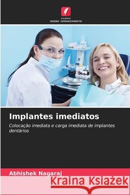 Implantes imediatos Nagaraj, Abhishek 9786209593642