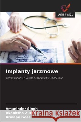Implanty jarzmowe Singh, Amaninder, Zutshi, Akanksha, Goel, Armaan 9786209607097