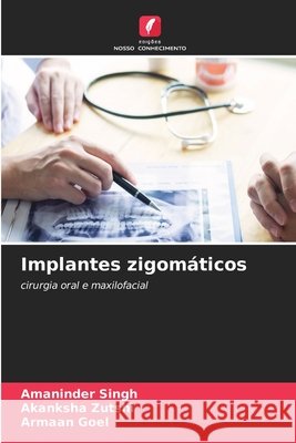 Implantes zigomáticos Singh, Amaninder, Zutshi, Akanksha, Goel, Armaan 9786209614774