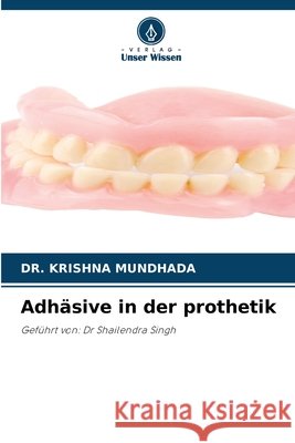 Adhäsive in der prothetik MUNDHADA, DR. KRISHNA 9786209623653