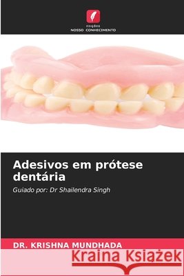 Adesivos em prótese dentária MUNDHADA, DR. KRISHNA 9786209631337
