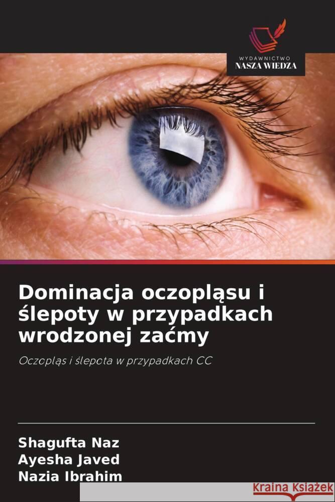 Dominacja oczoplasu i slepoty w przypadkach wrodzonej zacmy Naz, Shagufta, Javed, Ayesha, Ibrahim, Nazia 9786209648441 Wydawnictwo Nasza Wiedza