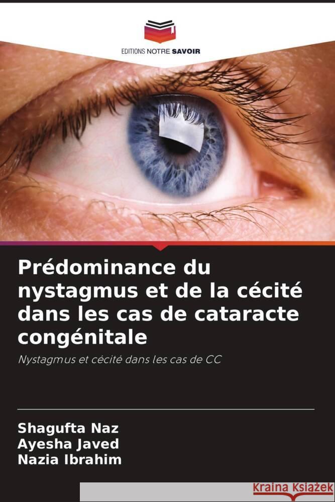 Pr?dominance du nystagmus et de la c?cit? dans les cas de cataracte cong?nitale Shagufta Naz Ayesha Javed Nazia Ibrahim 9786209653568 Editions Notre Savoir