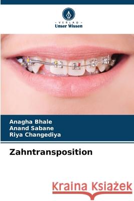 Zahntransposition Bhale, Anagha, Sabane, Anand, Changediya, Riya 9786209687365