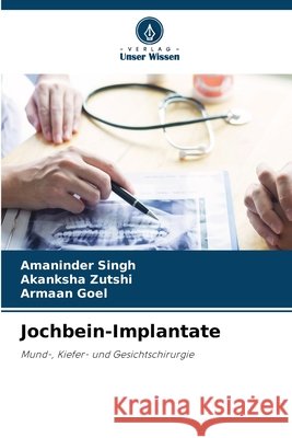 Jochbein-Implantate Singh, Amaninder, Zutshi, Akanksha, Goel, Armaan 9786209696695