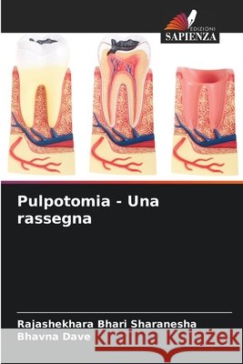 Pulpotomia - Una rassegna Bhari Sharanesha, Rajashekhara, Dave, Bhavna 9786209801587 Edizioni Sapienza