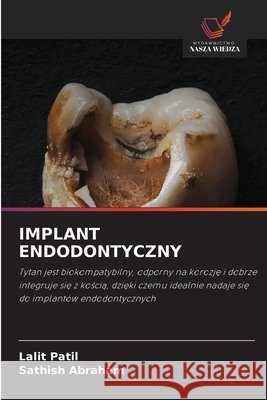 Implant Endodontyczny Patil, Lalit, Abraham, Sathish 9786209803864