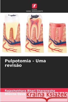Pulpotomia - Uma revisão Bhari Sharanesha, Rajashekhara, Dave, Bhavna 9786209806704 Edicoes Nosso Conhecimento