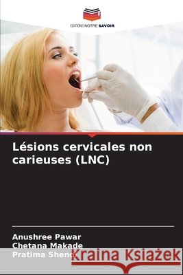 Lésions cervicales non carieuses (LNC) Pawar, Anushree, Makade, Chetana, Shenoi, Pratima 9786209819483