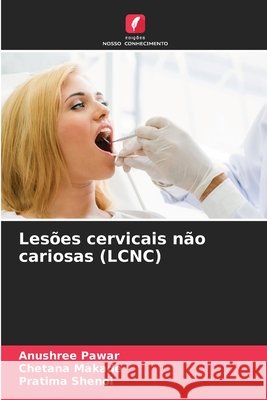 Lesões cervicais não cariosas (LCNC) Pawar, Anushree, Makade, Chetana, Shenoi, Pratima 9786209827167