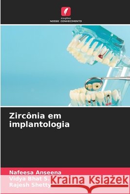 Zircônia em implantologia Anseena, Nafeesa, Bhat S., Vidya, Shetty, Rajesh 9786209837753