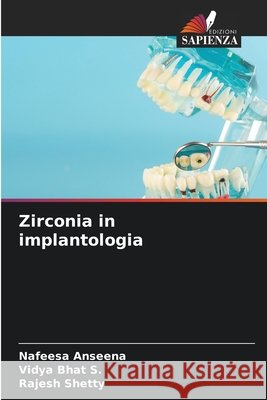 Zirconia in implantologia Anseena, Nafeesa, Bhat S., Vidya, Shetty, Rajesh 9786209840319