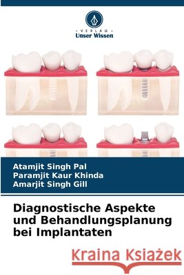 Diagnostische Aspekte und Behandlungsplanung bei Implantaten Pal, Atamjit Singh, Khinda, Paramjit Kaur, Gill, Amarjit Singh 9786209841521
