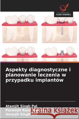 Aspekty diagnostyczne i planowanie leczenia w przypadku implantów Pal, Atamjit Singh, Khinda, Paramjit Kaur, Gill, Amarjit Singh 9786209851766