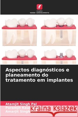 Aspectos diagnósticos e planeamento do tratamento em implantes Pal, Atamjit Singh, Khinda, Paramjit Kaur, Gill, Amarjit Singh 9786209854323