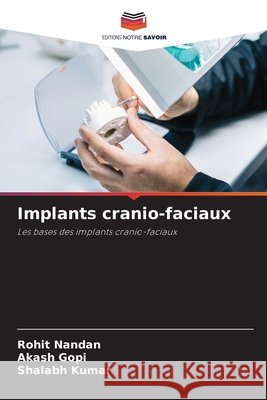 Implants cranio-faciaux Nandan, Rohit, Gopi, Akash, Kumar, Shalabh 9786209888007