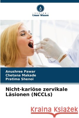Nicht-kariöse zervikale Läsionen (NCCLs) Pawar, Anushree, Makade, Chetana, Shenoi, Pratima 9786209896279